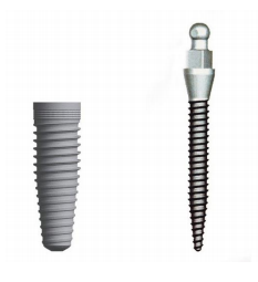 Mini Dental Implants - mini-dental-implants